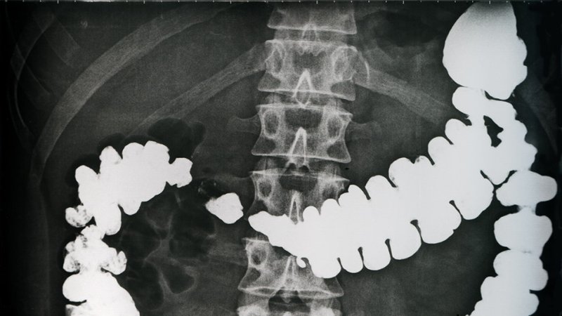 Isotopes with a short half-live are used in medicine for contrast imaging of some organs. In the patient’s body, they decay very rapidly. (Source: © Danilo Ascione / stock.adobe.com)