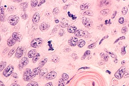 Macro-photograph of cells damaged by a high dose of radiation. (Source: © David A Litman / stock.adobe.com) Macro-photograph of cells damaged by a high dose of radiation. (Source: © David A Litman / stock.adobe.com)